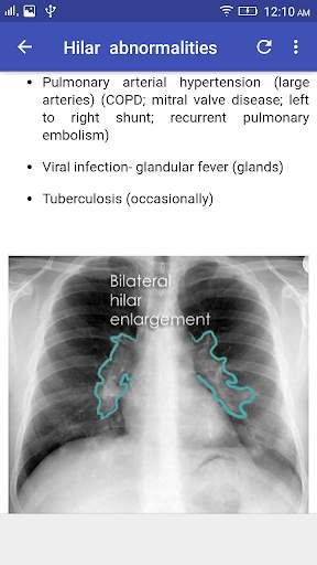 X-Ray Interpretation screenshot 4