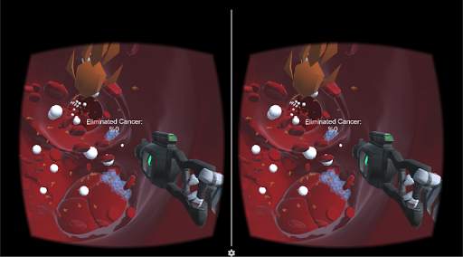 XCancer - VR Game screenshot 3