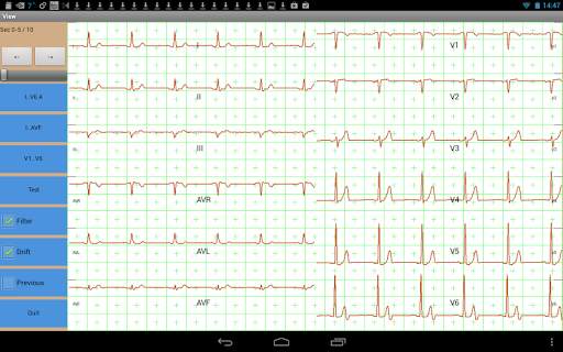 Mobile ecg recording screenshot 5