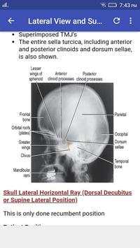 Skull Radiographic Positioning screenshot 6