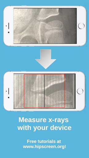 HipScreen screenshot 5