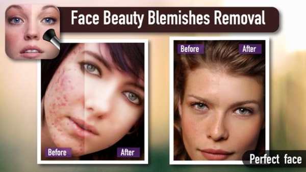 Face Beaty Blemishes Removal 2 تصوير الشاشة