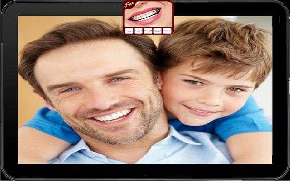 Braces Teeth Camera 5 تصوير الشاشة