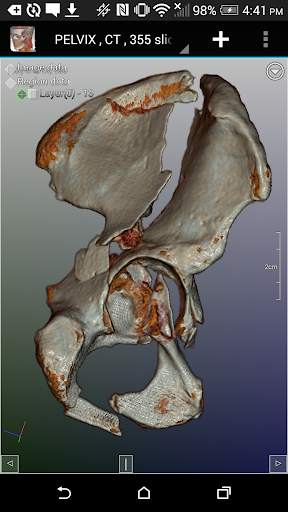 DroidRender - 3D DICOM viewer स्क्रीनशॉट 6