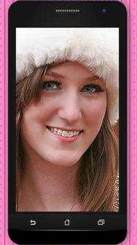 Braces Photos screenshot 3