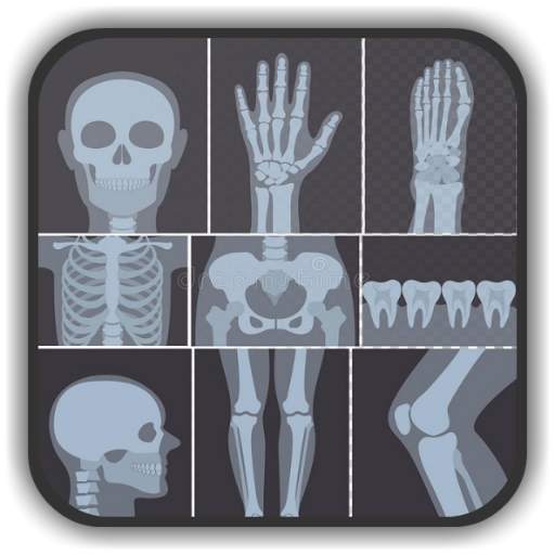 X-ray Interpretation for Medic 2.9