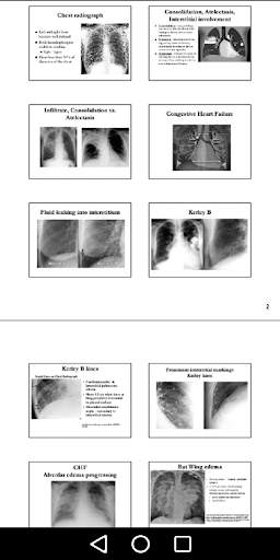 Medical X-Ray Interpretation w screenshot 3