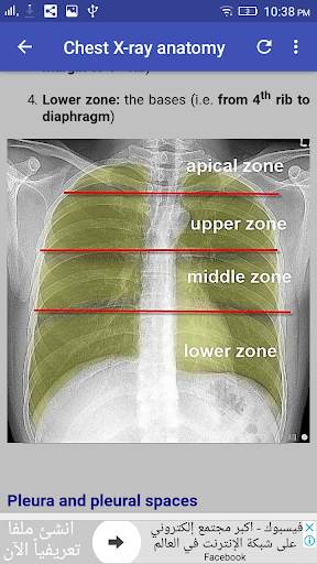Chest X-Ray Interpretation screenshot 6