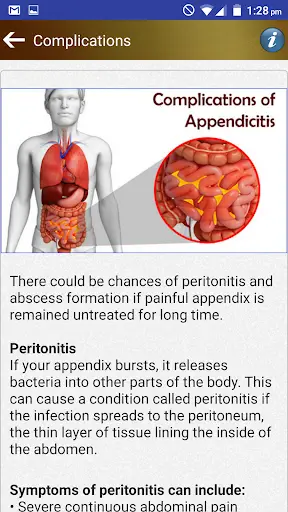 Appendix Diet Foods Help Tips screenshot 5