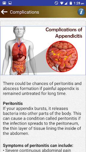 Appendix Diet Foods Help Tips скриншот 5
