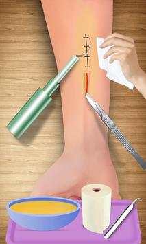 Arm Bone Doctor: Hospital Games & Surgery Games screenshot 17