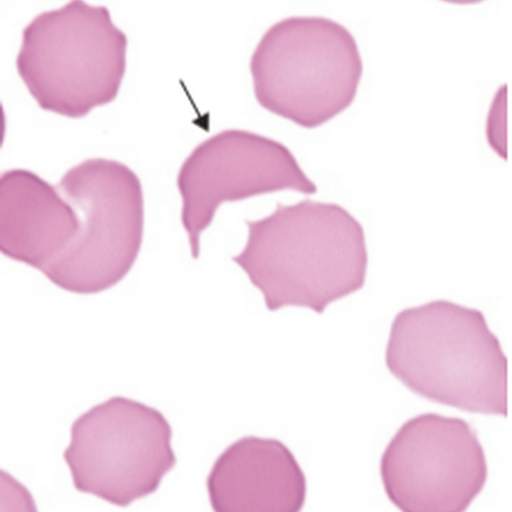 Hematology quiz App screenshot 5
