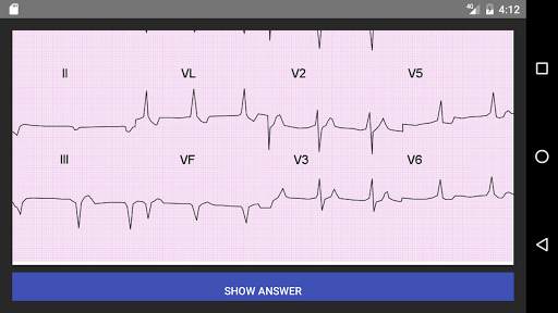 ECG 100 Clinical Cases screenshot 5