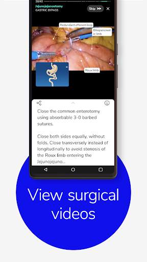 Touch Surgery: Surgical Videos screenshot 6