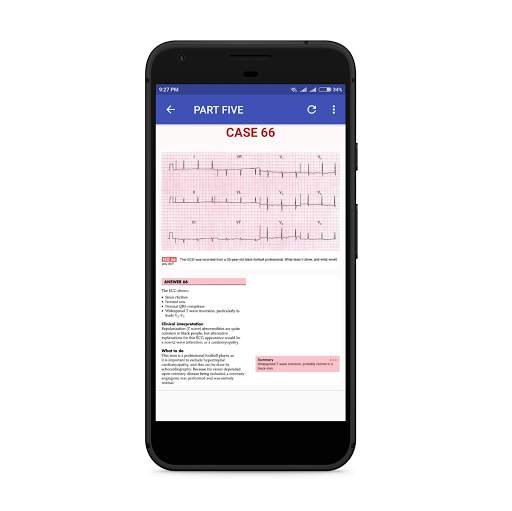 ECG Cases screenshot 4