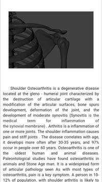 Arthritis Rehab screenshot 4