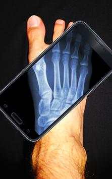 Real X Ray Body Scanner Prank: X Ray App screenshot 5