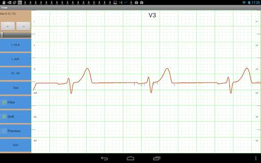 Mobile ecg recording screenshot 6