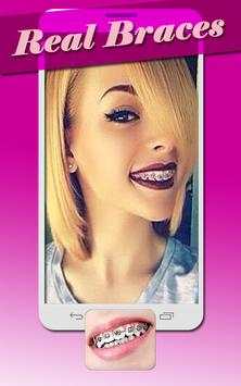 Real Braces Teeth Booth Pro screenshot 2