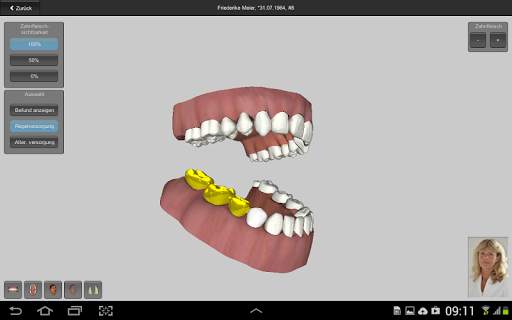 CGM VISODENT 3D App screenshot 6
