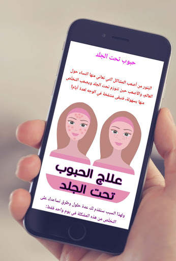10 طرق لعلاج الحبوب تحت الجلد screenshot 3