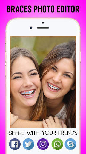 Braces 2.0 screenshot 5