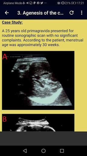 Ultrasound Complete Guide screenshot 5