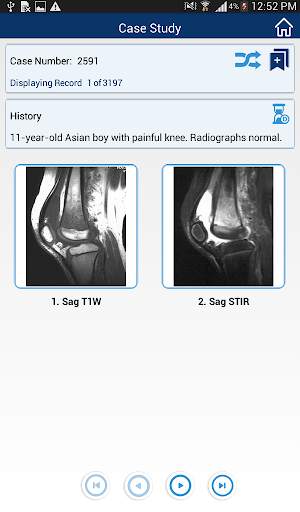 MSK RADIOLOGY 4 U screenshot 9