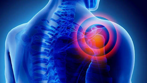 shoulder pain screenshot 2