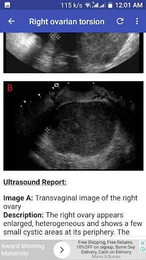 Ultrasound Guide A2Z 7 تصوير الشاشة