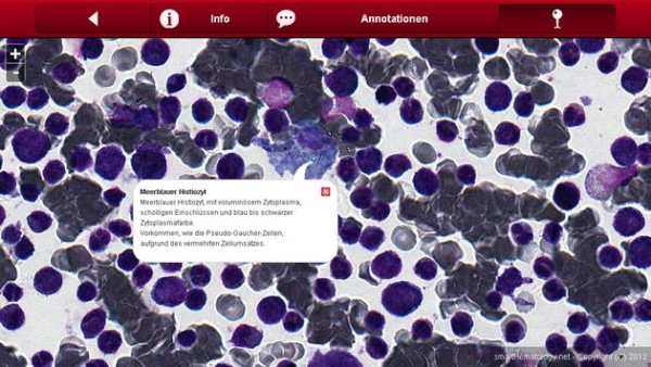 Smart Hematology Lite screenshot 12