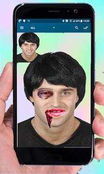 Injury Photo Editor-Fake Injury Photo Editor 2019 screenshot 2