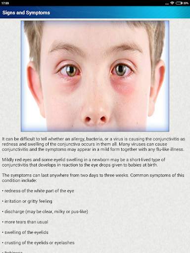 Help for Baby Conjunctivitis & Pinkeye in Children screenshot 10