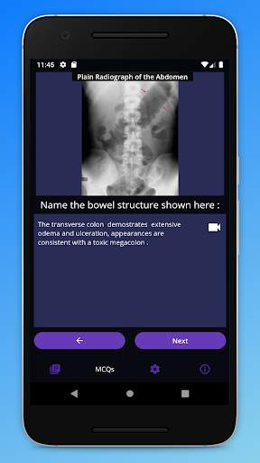 Basic Radiology for medical students screenshot 5
