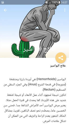علاج البواسير الداخلية والخارجية 5 تصوير الشاشة