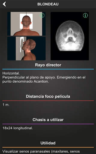 RX - Posiciones Radiológicas screenshot 9