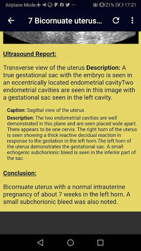 Ultrasound Complete Guide screenshot 7