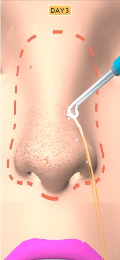 Nose Clean screenshot 6