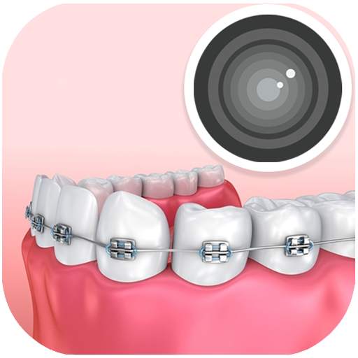 Braces photo editor & braces filter 12.1