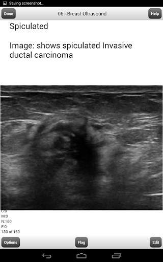BREAST ULTRASOUND BOARDS FLASHCARDS LITE screenshot 3