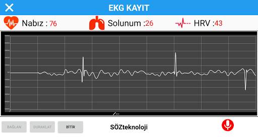 Mini EKG स्क्रीनशॉट 6
