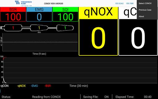 Conox View screenshot 12