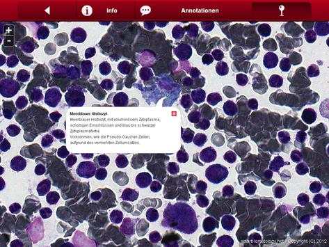 Smart Hematology Lite screenshot 8