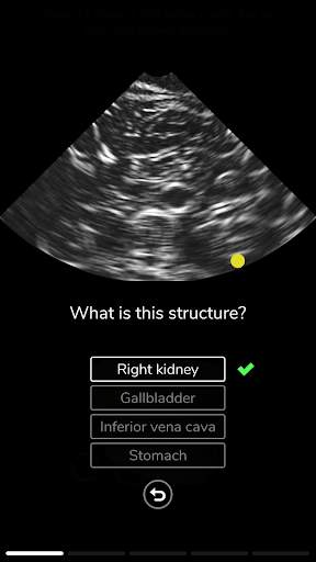 Deepscope Ultrasound Simulator screenshot 4