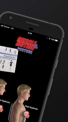 Posture by Muscle & Motion screenshot 2