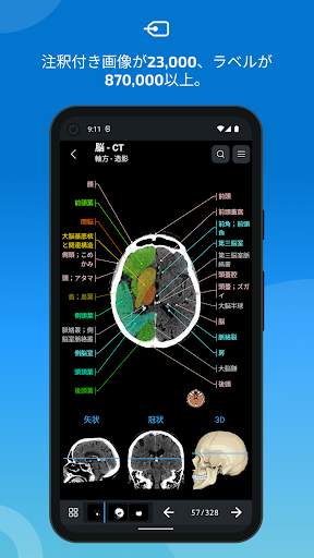 e-Anatomy screenshot 2