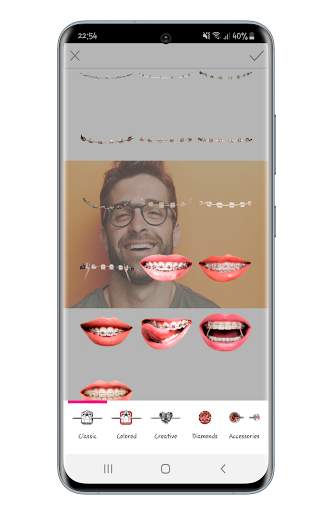 Beauty Camera Braces screenshot 5