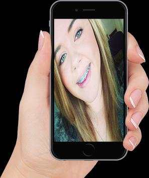 Real Braces teeth screenshot 2