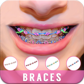 Braces Camera Beauty Selfie icon