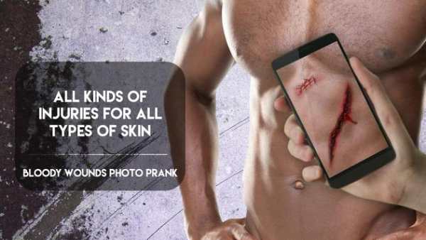 Bloody Wounds Photo PRANK screenshot 3